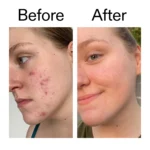 The Inkey List - 15% Vitamin C + Egf Serum - 30ml - Image 2
