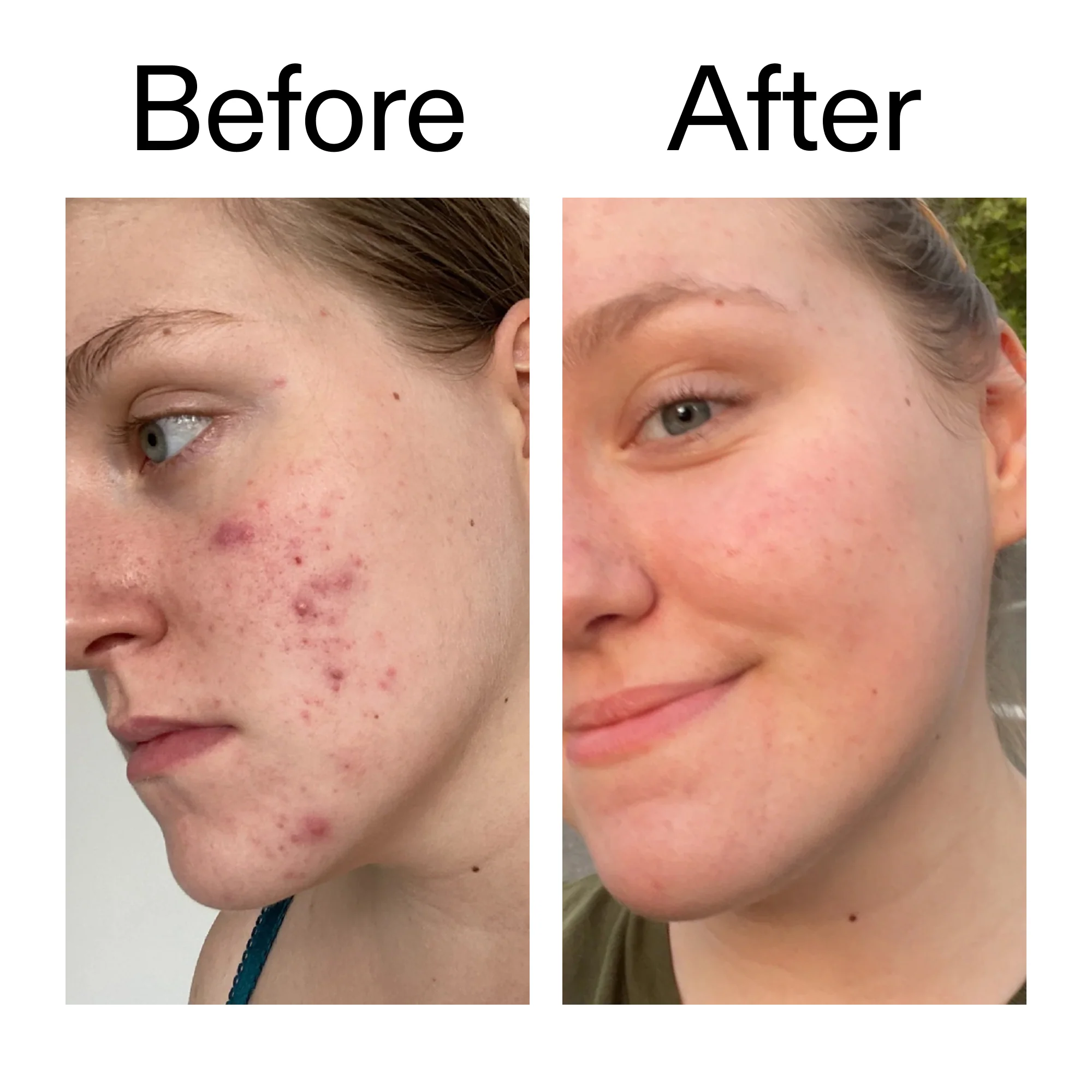 The Inkey List - 15% Vitamin C + Egf Serum - 30ml - Image 2