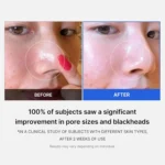 Medicube - Zero Pore Pad 2.0 (70pcs) - Image 3