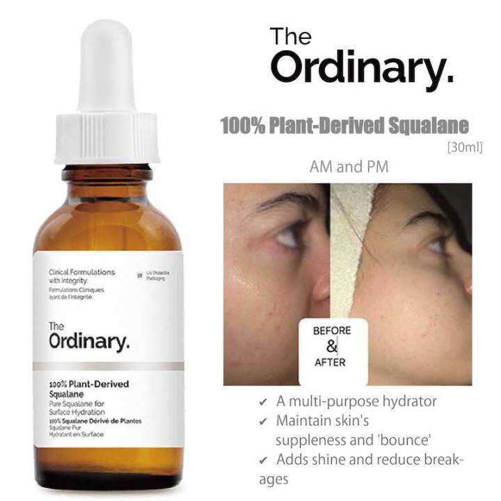 Ordinary - 100% Plant Derived Squalane - 30ml  100% Original Products In  Bangladesh |