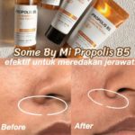 SOME BY MI - Propolis B5 Starter Kit - Image 2