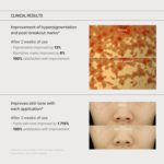 Some By Mi - Yuja Niacin Anti Blemish Cream - 60g - Image 5