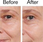The Inkey List - Retinol Eye Cream - 15ml - Image 5