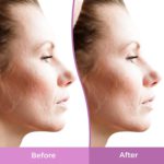 Differin - Resurfacing Scar Gel Treatment - 30ml - Image 4