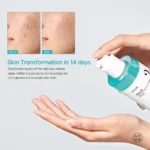 Anua - Bha 2% Gentle Exfoliating Toner - 150ml - Image 2