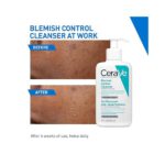 Cerave - Blemish Control Cleanser For Blemish Prone Skin - 236ml - Image 2