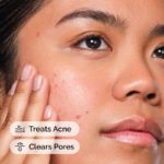Ordinary - Salicylic Acid 2% Solution - 30ml - Image 3