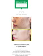 Some By Mi - Yuja Niacin Blemish Care Serum - 50ml - Image 5
