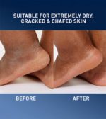 Cerave - Healing Ointment Protects & Soothes Dry, Cracked & Chafed Skin - 340gm - Image 3