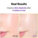 ISNTREE - Hyper Retinol Ex 1.0 Serum - 20ml - Image 4