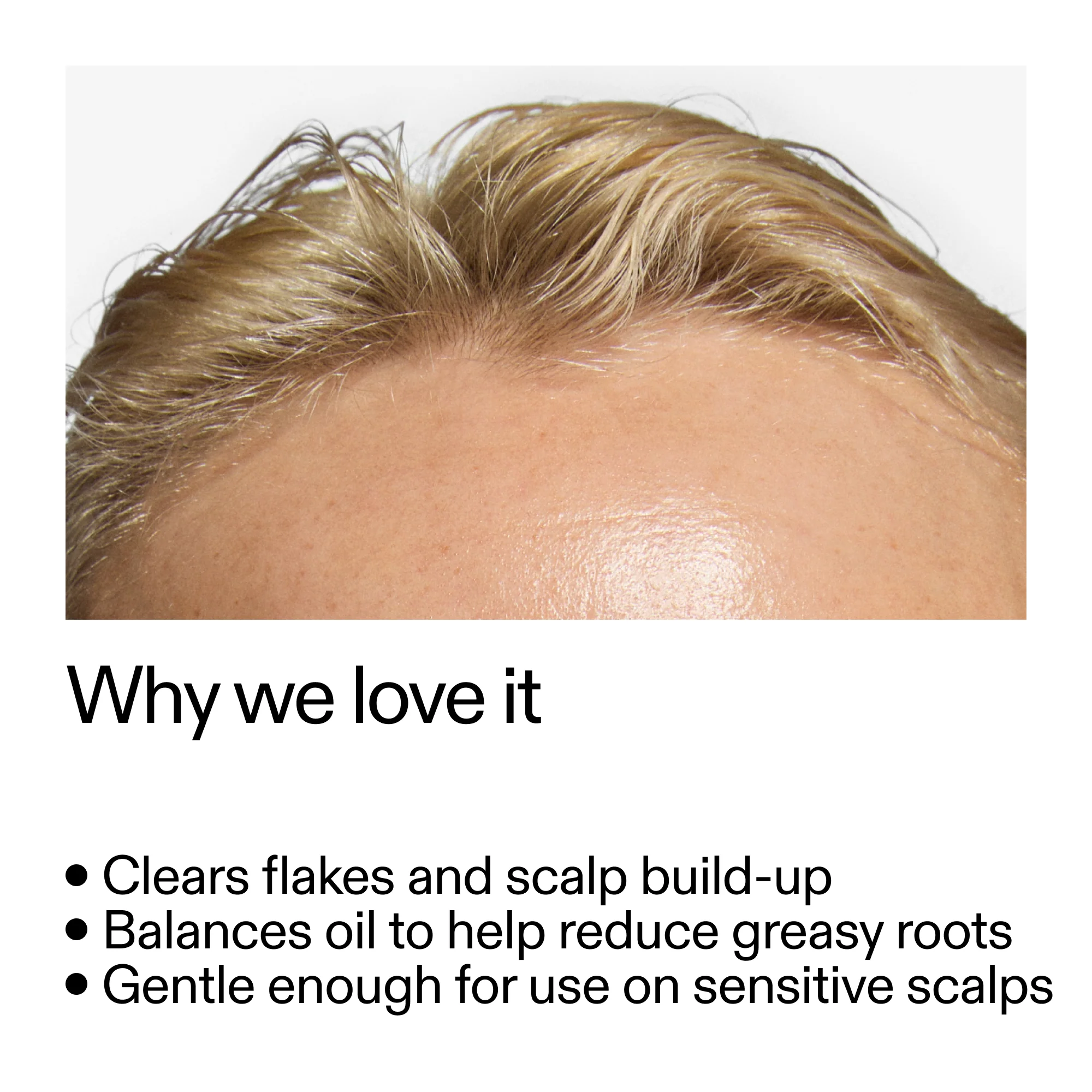 The Inkey List - Salicylic Acid Exfoliating Scalp Treatment - 150ml - Image 5