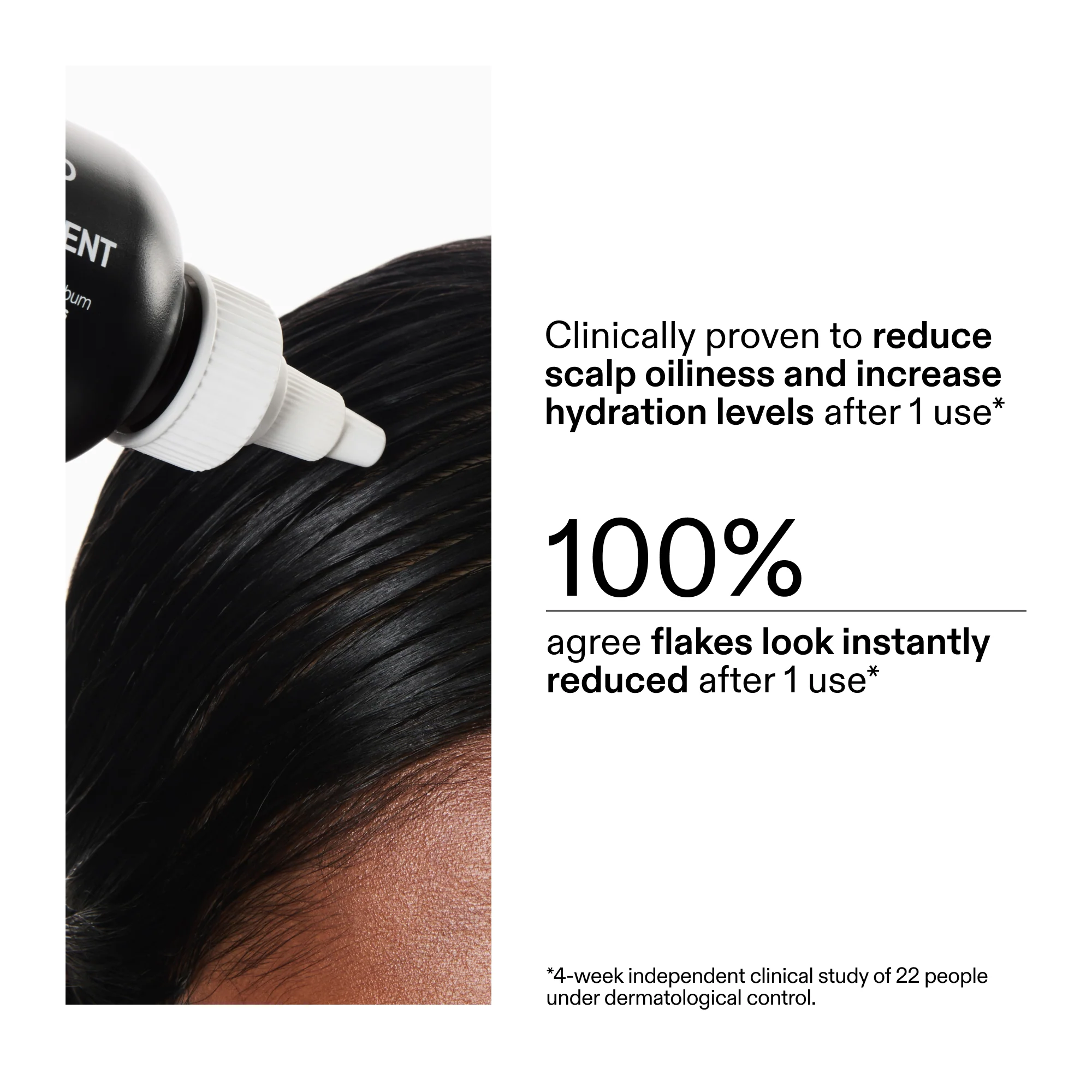 The Inkey List - Salicylic Acid Exfoliating Scalp Treatment - 150ml - Image 4