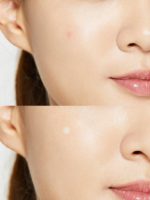 Cosrx - Acne Pimple Master Patch - Image 3