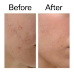 The Inkey List - Mandelic Acid Treatment - 15ml - Image 9
