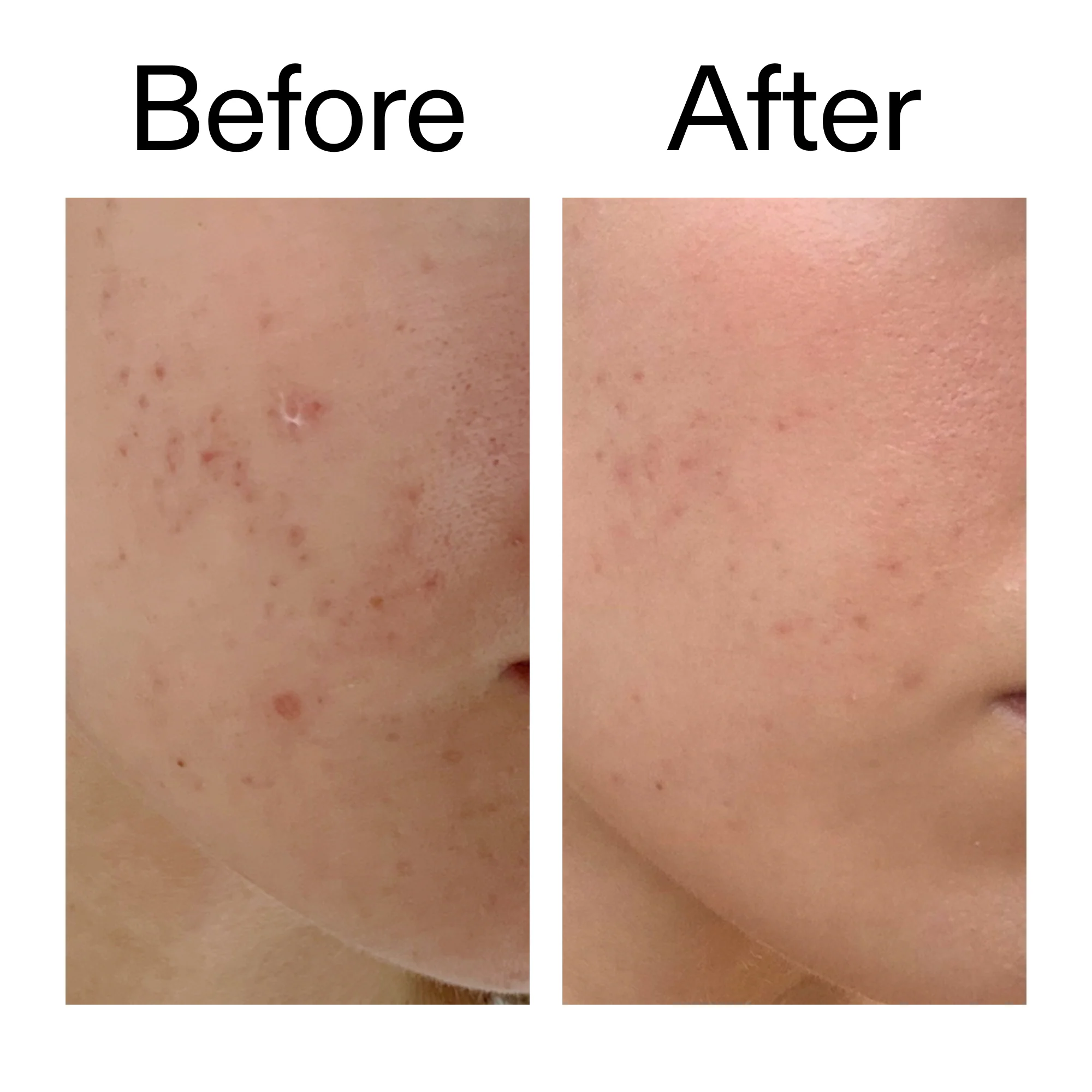 The Inkey List - Mandelic Acid Treatment - 15ml - Image 9