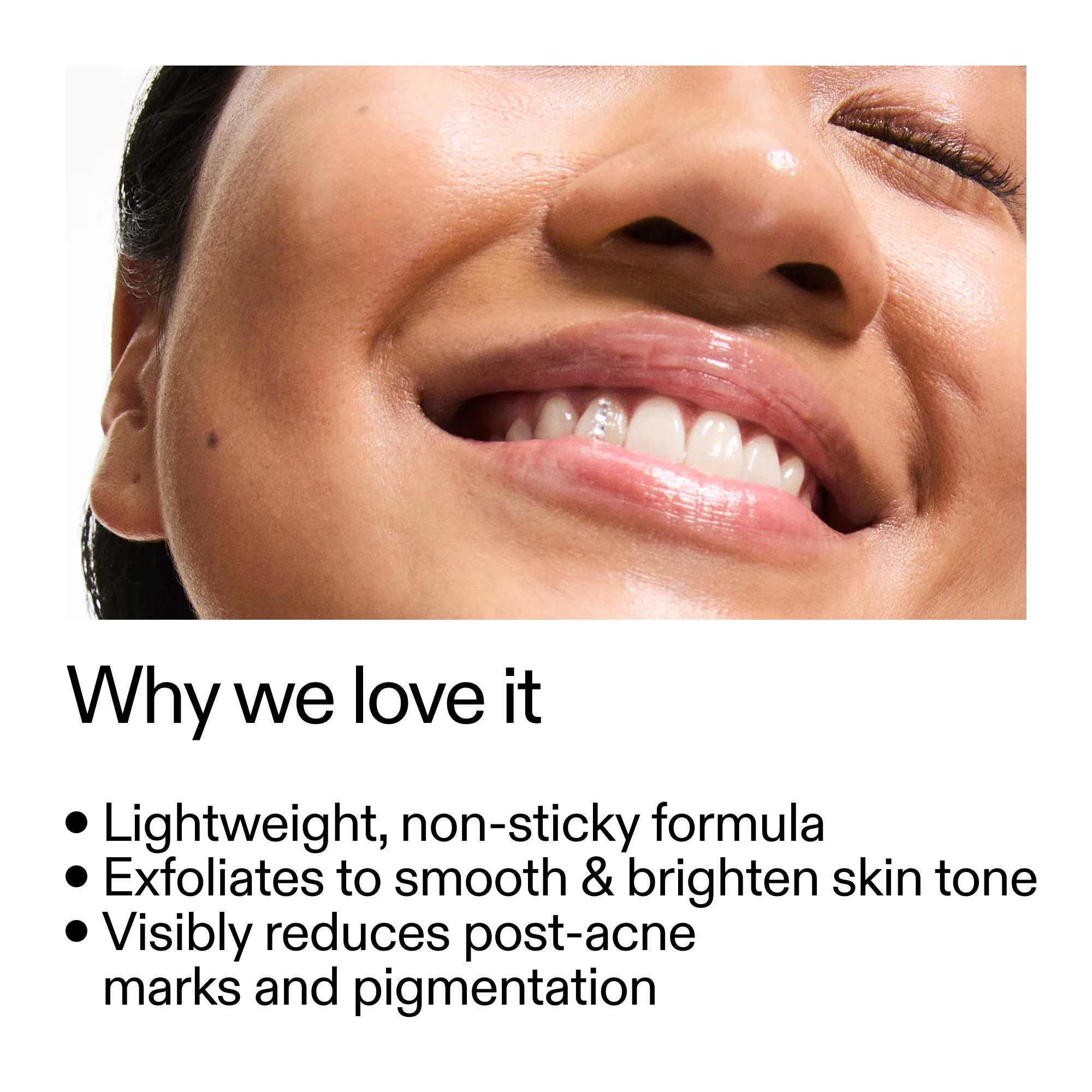 The Inkey List - Mandelic Acid Treatment - 15ml - Image 6