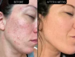 The Inkey List - Dry and Rough Skin Solution - 50ml - Image 8