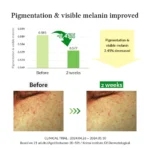 Dr Althea - Gentle Vitamin C Serum - 30ml - Image 5