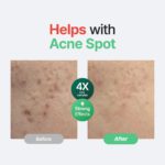 Purito - Wonder Releaf Centella Serum Unscented - Image 5