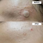 Nineless - A-Control 10% Azelaic Acid Serum - 30ml - Image 3