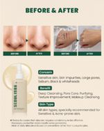 KSECRET - Seoul 1988 Cleansing Oil : Pine Cica 1% + Probiotics - 200ml - Image 3