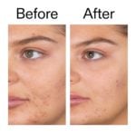 The Inkey List - Salicylic Acid Cleanser - Image 2