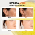 KSECRET - Seoul 1988 Glow Serum : Niacinamide 15% + Yuja - 30ml - Image 3