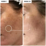 Nineless - B-Boost 1% Kojic Acid Serum - 30ml - Image 3
