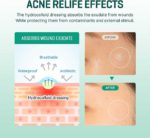 Some By Mi - 30 Days Miracle Clear Spot Patch - Image 5