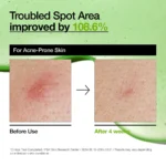 Anua - Azelaic Acid 10 Hyaluron Redness Soothing Serum - Image 5
